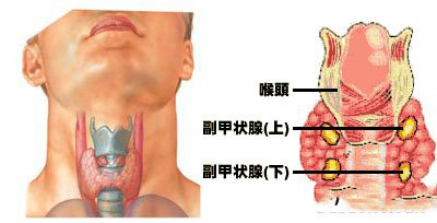 甲状腺肿大